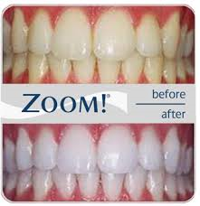 New Patient Power Whitening Special